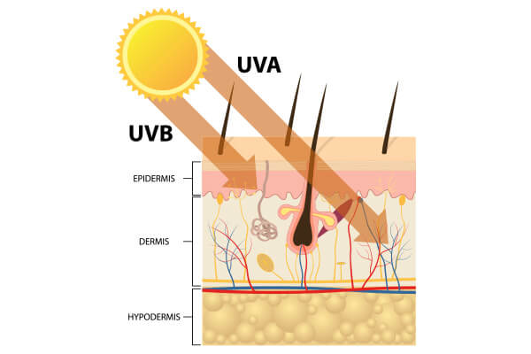 Collagen breakdown