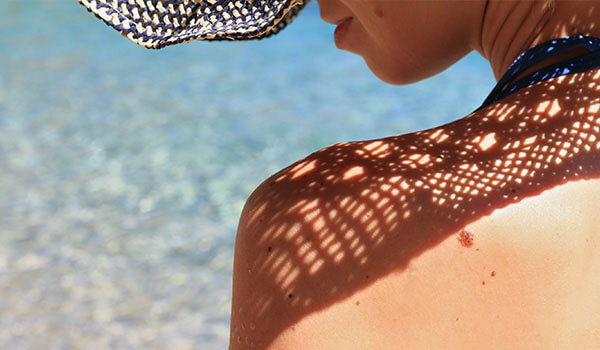 SUN SPOTS AND DARK SPOTS: WHAT’S THE DIFFERENCE?